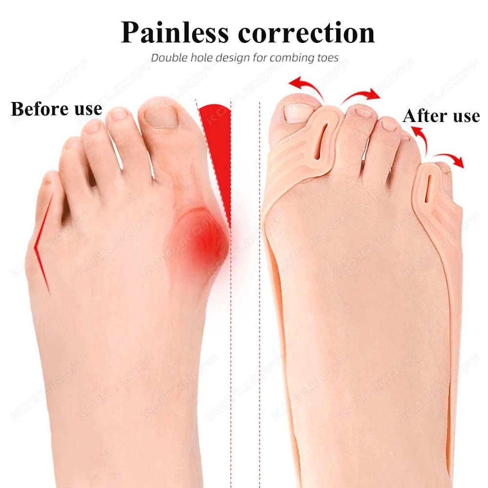 1 Pair Silicone Toe Separator Hallux Valgus Bunion Corrector Hammer Toe Straightener Foot Pain Relief Orthopedic Pedicure Tools