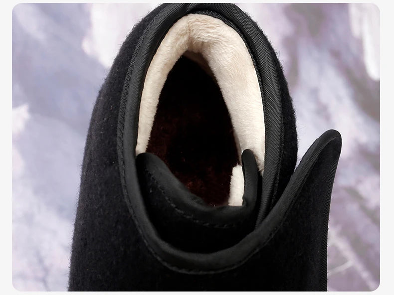 Women Warm Boots Winter Velvet Orthopedics Wide Feet Swollen Shoes Women Eversion Adjusting Soft Comfortable Diabetic Shoes